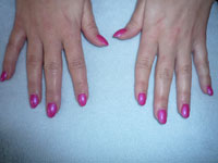 Gallery_Nails8
